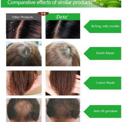 Dexe Herbal Anti Hair Loss Growth Unisex Shampoo - 200ml