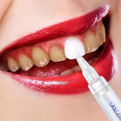 Teeth Whitening Gel Pen Home &amp; Travel Stain Removal Solution